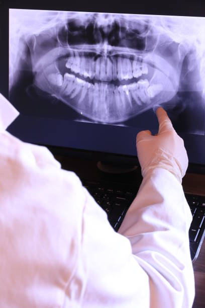 Best Emergency Root Canal Treatment in Edmond, OK